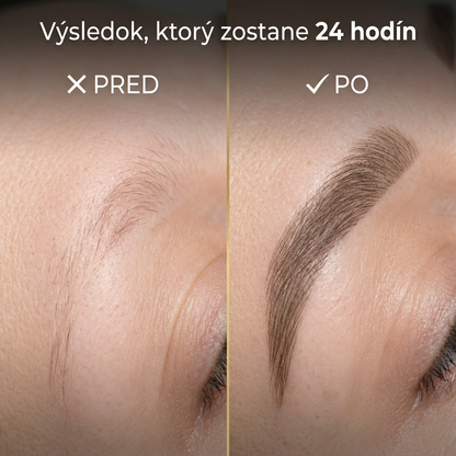 🔥 LIMITOVANÁ AKCIA: 🎁 KÚP 1 = DOSTANEŠ 3⚠️ Iba 6 kusov zostatok!